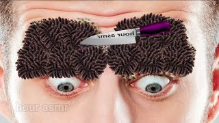 ASMR Whats🤭 this he eyes Asmr Animation treatment dog ticks and worm removal from eye 173 [upl. by Enuahs]