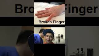 Broken Finger Symptoms and Causes  Diagnosis  Treatment  Prevention disease healthcare healthy [upl. by Hanahs]