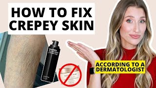 How to Fix Crepey Skin  Dermatologist Explains How to Firm Body Skin [upl. by Eelrak]