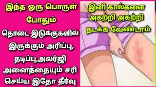 தொடை உரசிஉரசி தடிப்பு அரிப்பு ஏற்படுகிறதா இதோ தீர்வுRasi TipsCandid powderrashesitching [upl. by Winifred512]