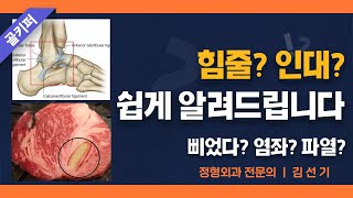 힘줄 힘줄염 인대 인대파열 알쏭달쏭 헷갈릴 땐 [upl. by Enahc]