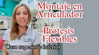 Montaje en articulador para prótesis flexible [upl. by Lose593]