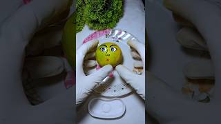 Lemon infection surgery 🍋shorts fruitsurgery ‎Fruitfix54 [upl. by Rafaelita]