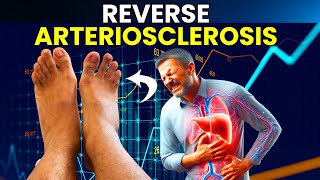 1 Food To REVERSE Arteriosclerosis Blood Clots amp Clogged Arteries [upl. by Quarta457]