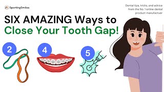 SIX AMAZING WAYS to Get Rid of that Tooth Gap [upl. by Pennington]