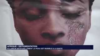 AFRIQUE  DEPIGMENTATION  ECLAIRCIR ARTIFICIELLEMENT LA PEAU EST NUISIBLE A LA SANTE [upl. by Naitsirhk]