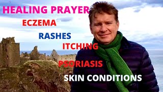 Healing prayer for skin eczema rashes psoriasis itchiness with John Mellor at Dunnottar Castle [upl. by Huppert]