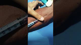 How to blood sample collection by venipuncture method blooddonation medico lab [upl. by Corron]