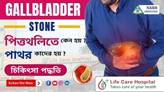 Gallstones Causes and Prevention  Dr A Rahaman [upl. by Hallam]