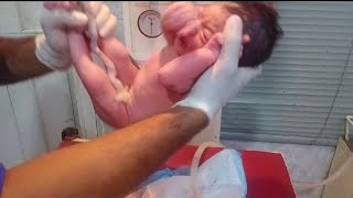 New born baby female recived with no breath and no cry take action all the efforts used baby cry😥🥰 [upl. by Francisco585]