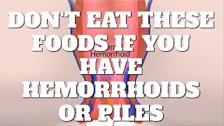 5 Foods You Should Not Eat If You Have Hemorrhoids or Piles [upl. by Gile511]