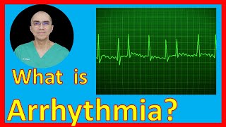 What is Arrhythmia [upl. by Brittnee]