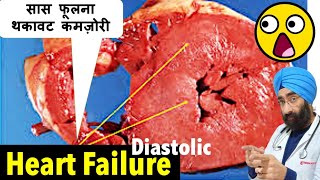 क्या होता है HFpEF  Diastolic Heart Failure with Preserved Ejection Fraction  DrEducation [upl. by Bolanger216]