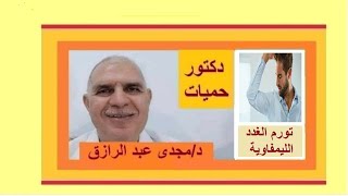 تورم الغدد الليمفاوية تحت الإبط  swollen lymph nodes under the armpit [upl. by Nyrad182]