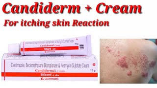 Candiderma  Cream  Candiderma Plus Cream  Candiderma  Cream Use Benefit Dosage Review in hindi [upl. by Marley18]