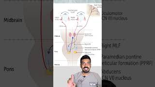 Internuclear Ophthalmoplegia concept explained in 3minutes [upl. by Keir18]