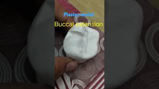 Buccal extension plaster model cavity shorts bds dentist [upl. by Biernat]