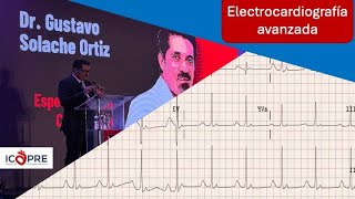 Electrocardiografía avanzada Fibrilación atrial [upl. by Trahern]