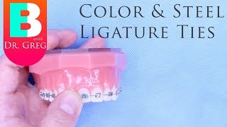 BRACES EXPLAINED Color and Steel Ligature Ties [upl. by Sauls829]