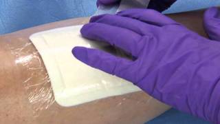 3M™ Tegaderm™ Foam Adhesive Dressing  Application and Removal [upl. by Eislrahc]