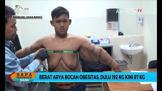 Berat Badan Turun Lebih dari 100 Kg Arya Permana Akan Operasi Plastik untuk Buang Kulit Gelambir [upl. by Aicinad367]