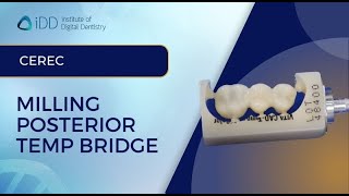 CEREC Milling Posterior Temp Bridge  iDD [upl. by Attelrahs]