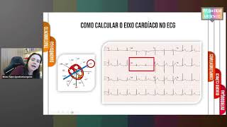 Eletrocardiograma na pericardite aguda pediátrica [upl. by Adnerad]