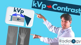 kVp and xray Contrast Guide for Radiologic Technologists [upl. by Enilehcim305]