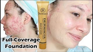 😲 FOUNDATION THAT CAN COVER ACNE  Dermacol Foundation [upl. by Aridni]