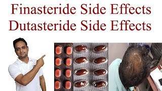 Finasteride Side Effects  Dutasteride Side Effects [upl. by Christen409]