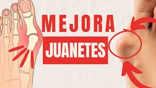 ¿JUANETES Mejóralos con estos ejercicios [upl. by Tinya]