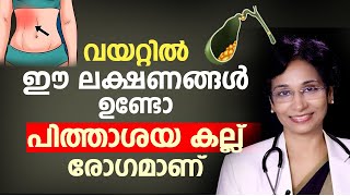 വയറ്റിൽ ഈ ലക്ഷണങ്ങൾ ഉണ്ടോ പിത്താശയ കല്ല് രോഗമാണ്  pithashayathil kallu  Arogyam [upl. by Sarah]