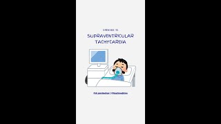 Supraventricular Tachycardia [upl. by Durgy]