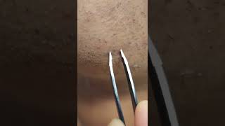 Plucking Stubborn Hairs With Tweezers ASMR tweezers [upl. by Jeromy]