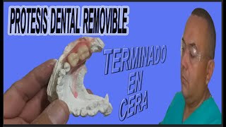 ENCERADO DE PRÓTESIS DENTAL REMOVIBLE [upl. by Hedvig]