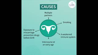 Things You Need to Know About Cervical Cancer  CARE Hospitals [upl. by Danete]