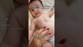 Sabe o que é exantema súbito ou roséola infecção viral que atinge bebês shots maternidade baby [upl. by Lita860]