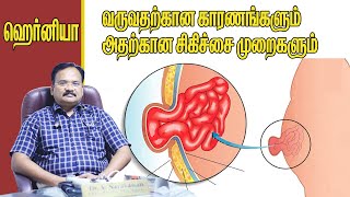 Types of Hernia and Hernia Treatment in Tamil Doctor Advice [upl. by Levram596]