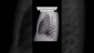 Frontal amp Lateral Chest XRAY  3D Representation [upl. by Adda]