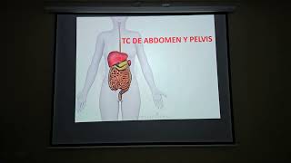 TOMOGRAFÍA DE ABDOMEN Y PELVIS ANATOMIA Y REALIZACION DESDE EL AULA [upl. by Llertnauq]