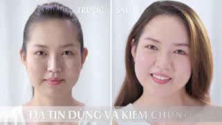 Kem dưỡng da Eucerin Pro Acne Solution AI MATT Fluid  Giải pháp 5 trong 1 cho da mụn [upl. by Blockus]