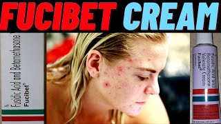 fucibet cream use in hindi how to use fucibet cream side amp effects and benefits [upl. by Lrig]