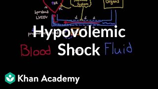 Hypovolemic shock  Circulatory System and Disease  NCLEXRN  Khan Academy [upl. by Haggai]