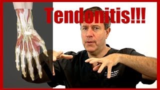 Do I Have Tendonitis In My Wrist [upl. by Itoc]