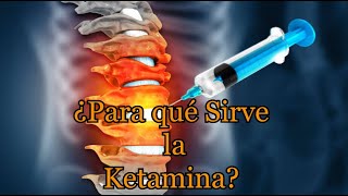 ¿Para qué Sirve la Ketamina [upl. by Vidda]