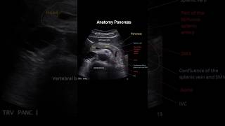 Anatomy PancreasUSG xray radiology anatomy usg pancreas [upl. by Emmalynn]