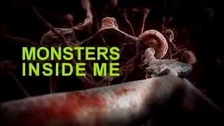 Monsters Inside Me Scabies Mite [upl. by Kramlich]