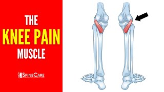 The Knee Pain Muscle How to Release It for INSTANT RELIEF [upl. by Aisa87]