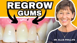 How To REGROW Receding Gums FIX Gum Recession At Home [upl. by Nnyloj]