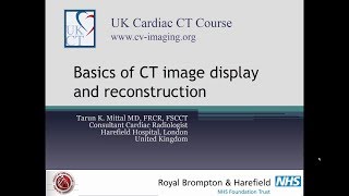 CT image display and reconstruction [upl. by Llehcar]